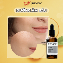 Translation missing: vi.sections.featured_product.gallery_thumbnail_alt
