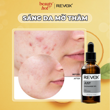 Translation missing: vi.sections.featured_product.gallery_thumbnail_alt
