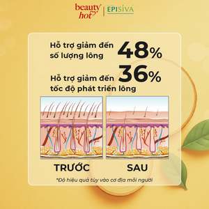 Lăn Khử Mùi Episiva Chăm Sóc Da Sau Khi Làm Sạch Lông Dành Cho Nữ 50ml
